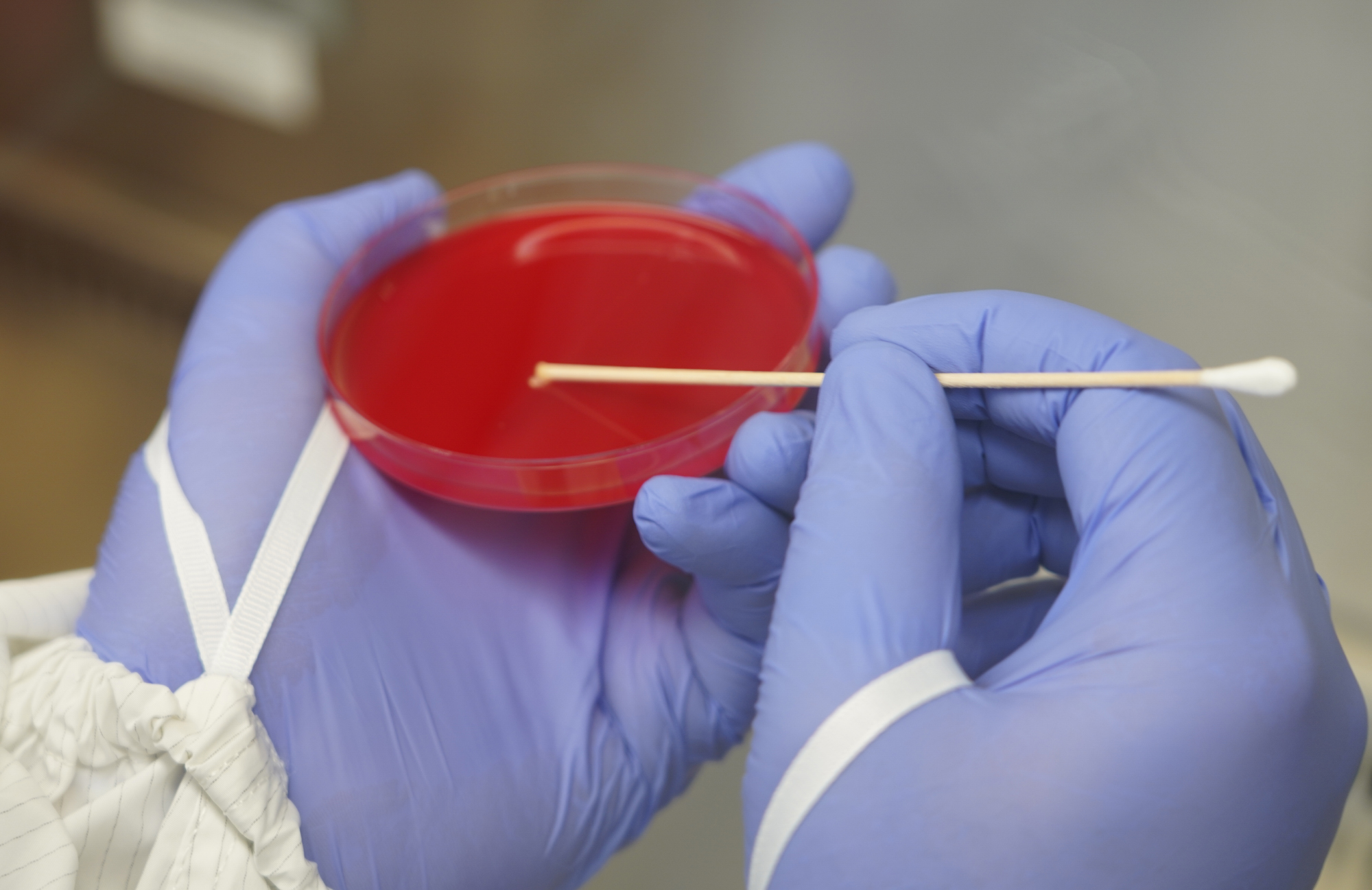 holding a petri dish