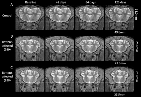 MRI image of the brain