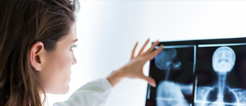woman looking at xrays